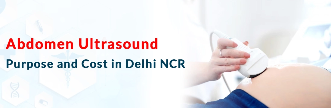 Abdomen Ultrasound: Purpose and Cost in Delhi NCR